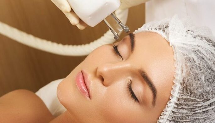 Թերմոլիֆտինգ