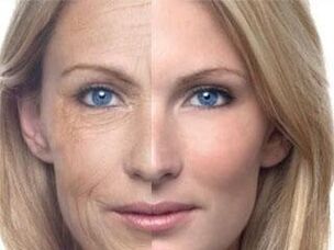 Մաշկի պիգմենտացիա