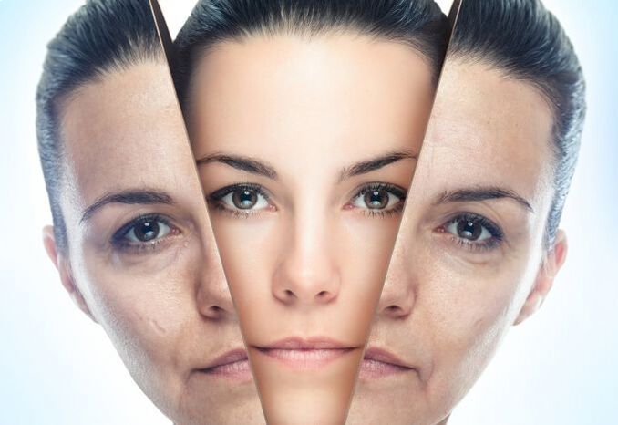 Դեմքի մաշկը տարիքային փոփոխություններից վերացնելու գործընթացը